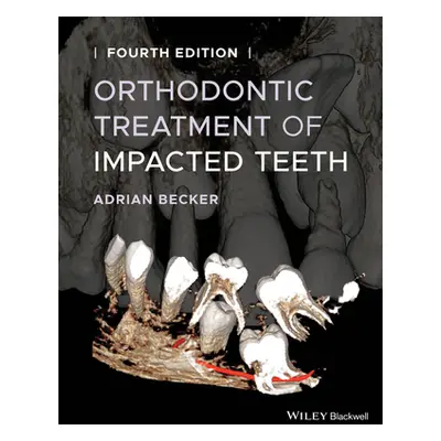 "Orthodontic Treatment of Impacted Teeth" - "" ("Becker Adrian")