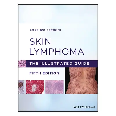 "Skin Lymphoma: The Illustrated Guide" - "" ("Cerroni Lorenzo")