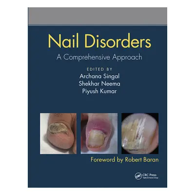 "Nail Disorders: A Comprehensive Approach" - "" ("Singal Archana")