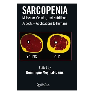 "Sarcopenia: Molecular, Cellular, and Nutritional Aspects - Applications to Humans" - "" ("Meyni