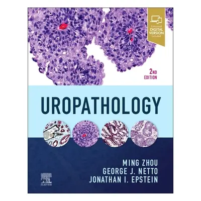 "Uropathology" - "" ("Zhou Ming")