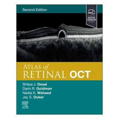 "Atlas of Retinal Oct: Optical Coherence Tomography" - "" ("Duker Jay S.")