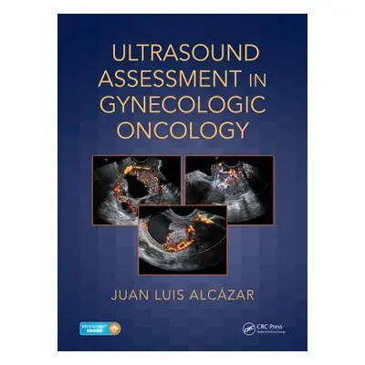 "Ultrasound Assessment in Gynecologic Oncology" - "" ("Alczar Juan Luis")