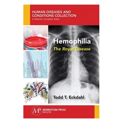 "Hemophilia: The Royal Disease" - "" ("Eckdahl Todd")