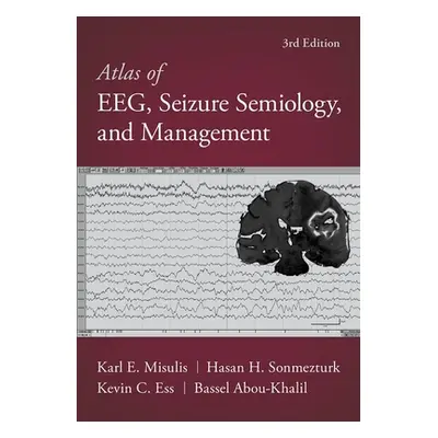 "Atlas of Eeg, Seizure Semiology, and Management" - "" ("Abou-Khalil Bassel")