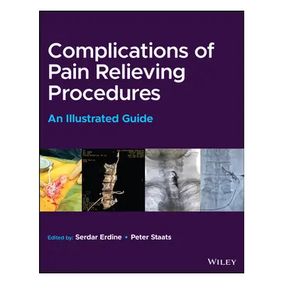 "Complications of Pain-Relieving Procedures: An Illustrated Guide" - "" ("Erdine Serdar")