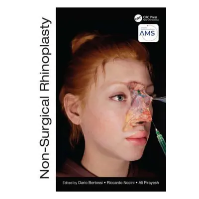 "Non-Surgical Rhinoplasty" - "" ("Bertossi Dario")