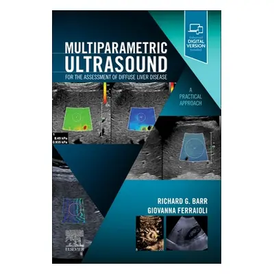 "Multiparametric Ultrasound for the Assessment of Diffuse Liver Disease: A Practical Approach" -