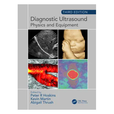 "Diagnostic Ultrasound: Physics and Equipment" - "" ("Hoskins Peter")