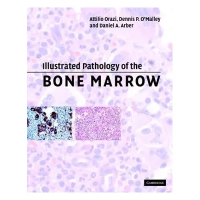 "Illustrated Pathology of the Bone Marrow" - "" ("Orazi Attilio")