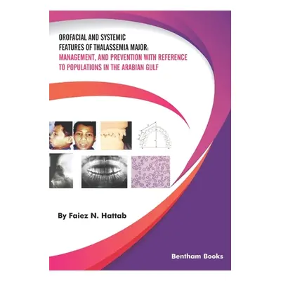 "Orofacial and Systemic Features of Thalassemia Major: Management, and Prevention with Reference