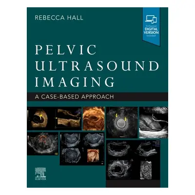 "Pelvic Ultrasound Imaging: A Cased-Based Approach" - "" ("Hall Rebecca")