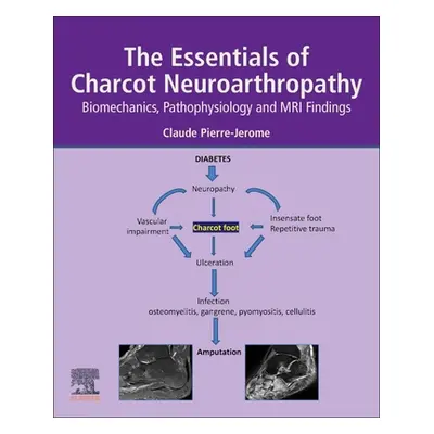 "The Essentials of Charcot Neuroarthropathy: Biomechanics, Pathophysiology, and MRI Findings" - 