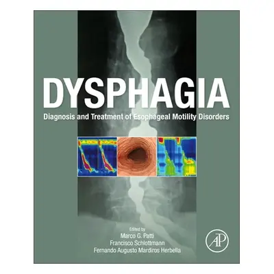 "Dysphagia: Diagnosis and Treatment of Esophageal Motility Disorders" - "" ("Patti Marco")