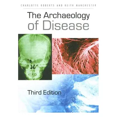 "The Archaeology of Disease" - "" ("Roberts Charlotte")