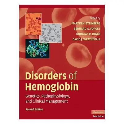 "Disorders of Hemoglobin: Genetics, Pathophysiology, and Clinical Management" - "" ("Steinberg M