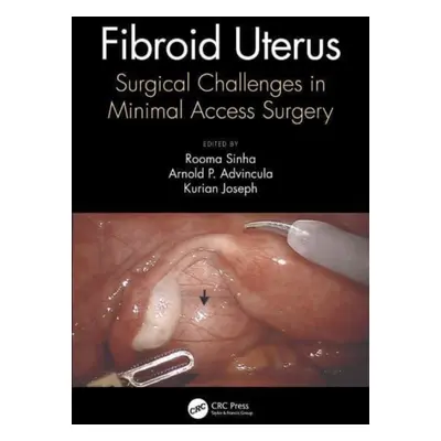 "Fibroid Uterus: Surgical Challenges in Minimal Access Surgery" - "" ("Sinha Rooma")