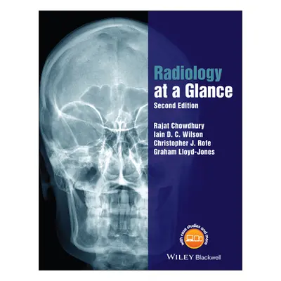 "Radiology at a Glance" - "" ("Chowdhury Rajat")