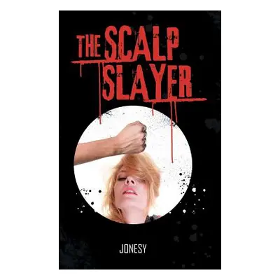 "The Scalp Slayer" - "" ("Jonesy")