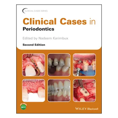 "Clinical Cases in Periodontics" - "" ("Karimbux Nadeem")