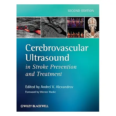 "Cerebrovascular Ultrasound in Stroke Prevention and Treatment" - "" ("Alexandrov Andrei V.")