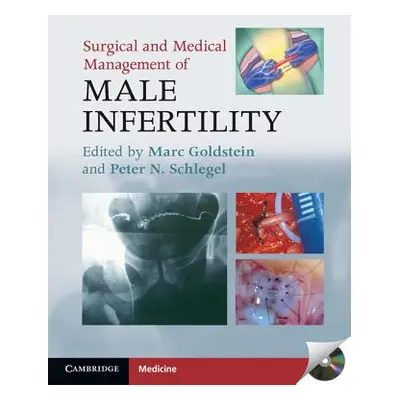 "Surgical and Medical Management of Male Infertility" - "" ("Goldstein Marc")