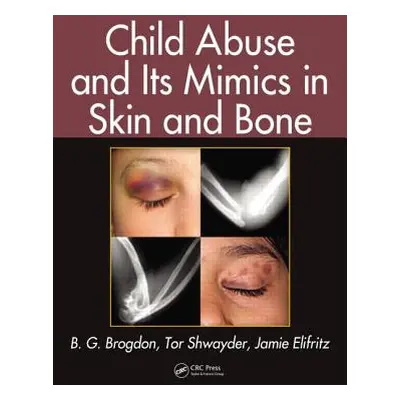 "Child Abuse and Its Mimics in Skin and Bone" - "" ("Brogdon B. G.")