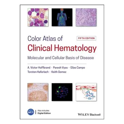 "Color Atlas of Clinical Hematology: Molecular and Cellular Basis of Disease" - "" ("Hoffbrand A