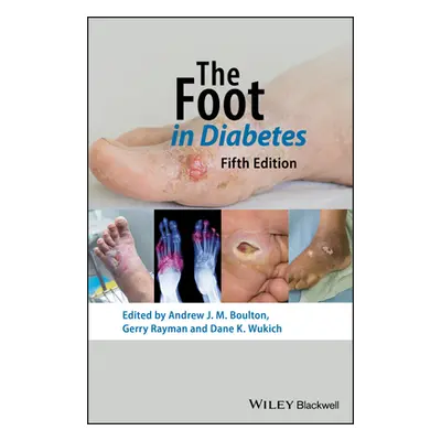 "The Foot in Diabetes" - "" ("Boulton Andrew J. M.")