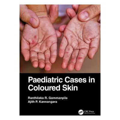 "Paediatric Cases in Coloured Skin" - "" ("Gammanpila Ranthilaka R.")