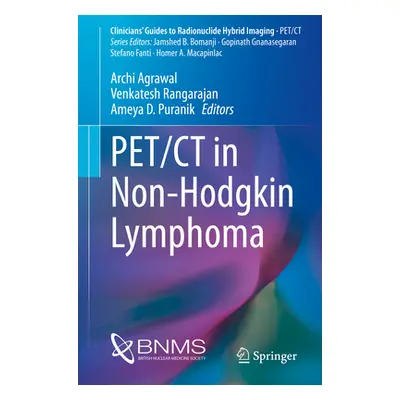 "Pet/CT in Non-Hodgkin Lymphoma" - "" ("Agrawal Archi")