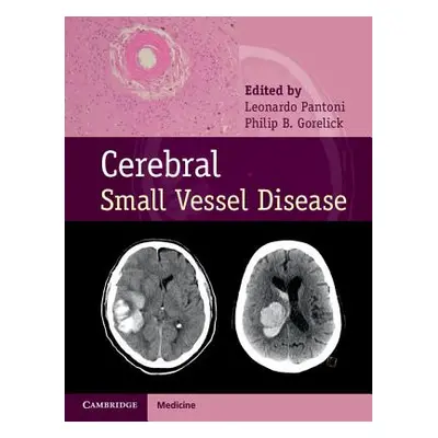 "Cerebral Small Vessel Disease" - "" ("Pantoni Leonardo")