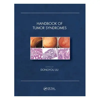 "Handbook of Tumor Syndromes" - "" ("Liu Dongyou")