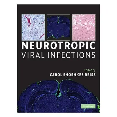 "Neurotropic Viral Infections" - "" ("")