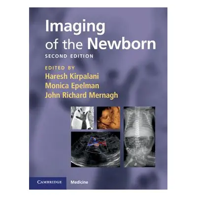 "Imaging of the Newborn" - "" ("Kirpalani Haresh")