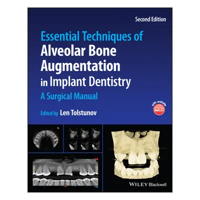 "Essential Techniques of Alveolar Bone Augmentation in Implant Dentistry: A Surgical Manual" - "