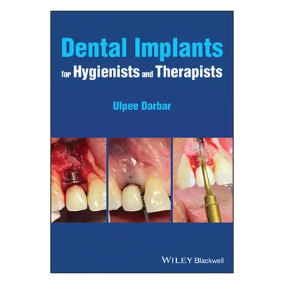 "Dental Implants for Hygienists and Therapists" - "" ("Darbar Ulpee R.")