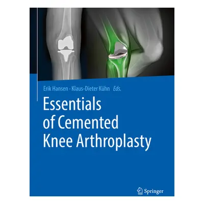 "Essentials of Cemented Knee Arthroplasty" - "" ("Hansen Erik")