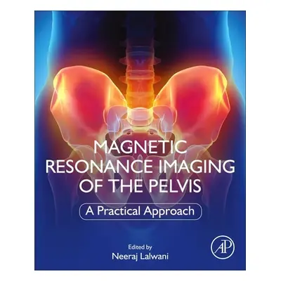 "Magnetic Resonance Imaging of the Pelvis: A Practical Approach" - "" ("Lalwani Neeraj")