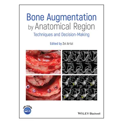 "Bone Augmentation by Anatomical Region: Techniques and Decision-Making" - "" ("Artzi Zvi")