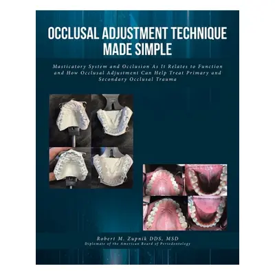 "Occlusal Adjustment Technique Made Simple: Masticatory System and Occlusion As It Relates to Fu