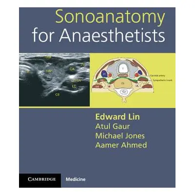 "Sonoanatomy for Anaesthetists" - "" ("Lin Edward")