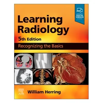 "Learning Radiology: Recognizing the Basics" - "" ("Herring William")