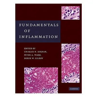 "Fundamentals of Inflammation" - "" ("Serhan Charles N.")