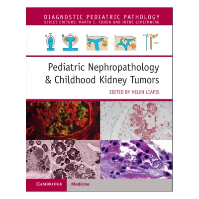 "Pediatric Nephropathology & Childhood Kidney Tumors with Online Resource" - "" ("Liapis Helen")