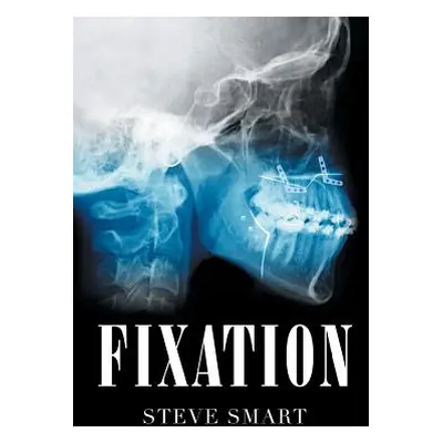 "Fixation" - "" ("Smart Steve")