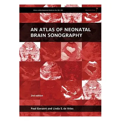 "An Atlas of Neonatal Brain Sonography" - "" ("Govaert Paul")