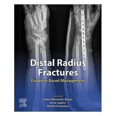 "Distal Radius Fractures" - "Evidence-Based Management" ("")