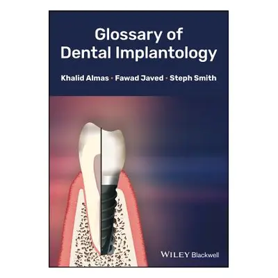 "Glossary of Dental Implantology" - "" ("Almas Khalid")