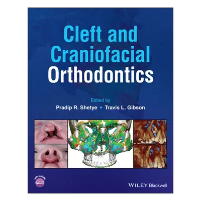 "Cleft and Craniofacial Orthodontics" - "" ("Shetye Pradip R.")